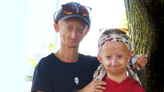 The FDA has approved the first drug to treat the rapid-aging disease progeria