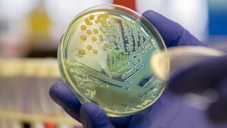 Antimicrobial resistance is a leading cause of death globally